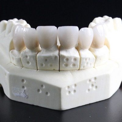 tooth-replacement-759929_640